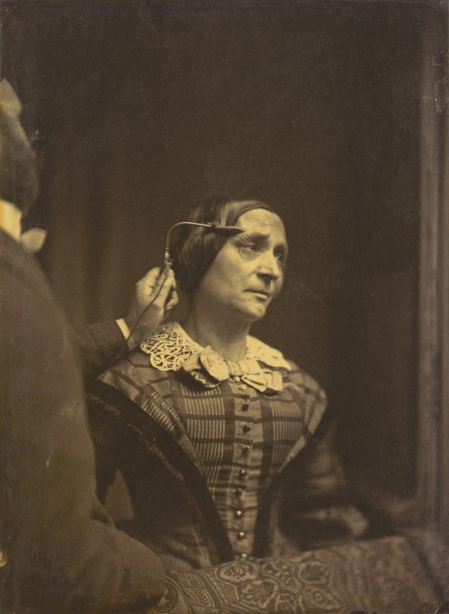 Figyelem, figyelmes tekintet (balra); Fájdalmas figyelem (jobbra),1854-1856, nyomtatás 1862 (fotó) alkotó: Guillaume Benjamin Armand Duchenne de Boulogne