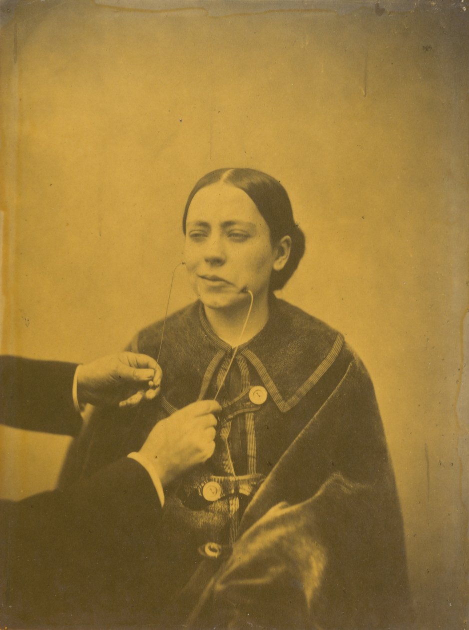 Gúnyos undor (balra); Gúnyos nevetés (jobbra),1854-1856, nyomtatva 1862 (fotó) alkotó: Guillaume Benjamin Armand Duchenne de Boulogne