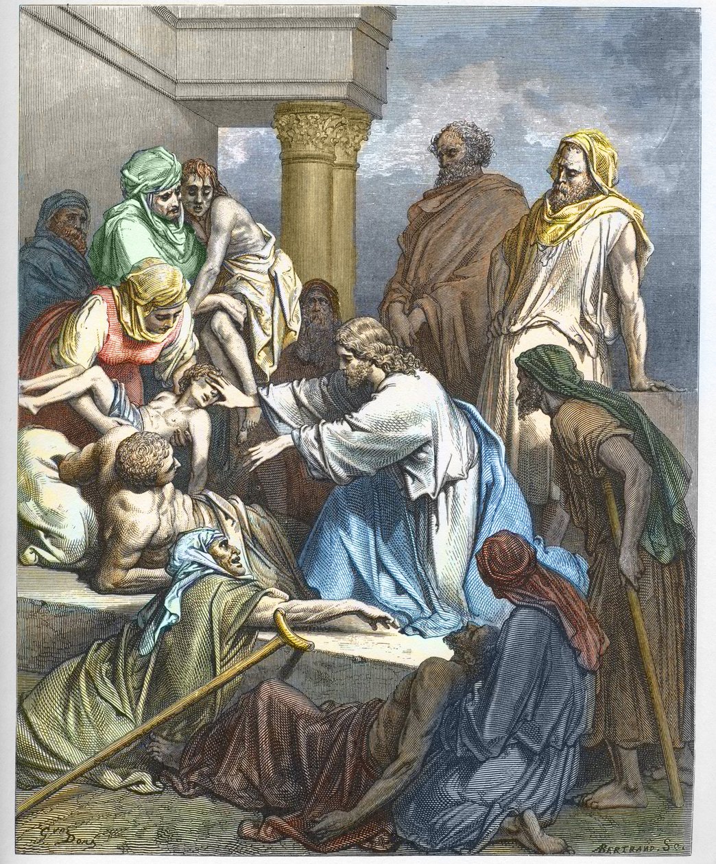 Jézus guerit les malades - Jézus betegeket gyógyít - - Gustave Dore (1832-1883) "" The Bible illustree"-be vésve - Metszet a Dore Bibliából" alkotó: Gustave Dore