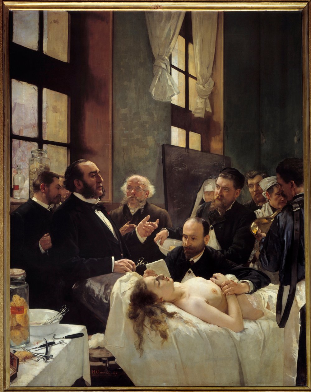 Dr. Jules Emile (Jules-Emile) Pean (1830-1898) a Saint Louis-i Kórházban tanítja a hajók becsípődésének felfedezését vagy a „műtét előtt”” Henri Gervex (1852-1929) festménye 1887 V. 2,42x1,88 m Párizs, Orsay Múzeum – Dr. Emile Jules (Jules-Emi alkotó: Henri Gervex