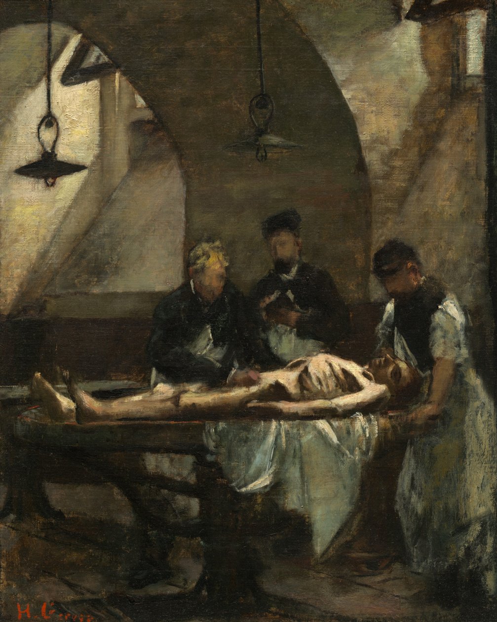 Bonctani tanulmány a Hôtel-Dieu-ban, 1876. alkotó: Henri Gervex