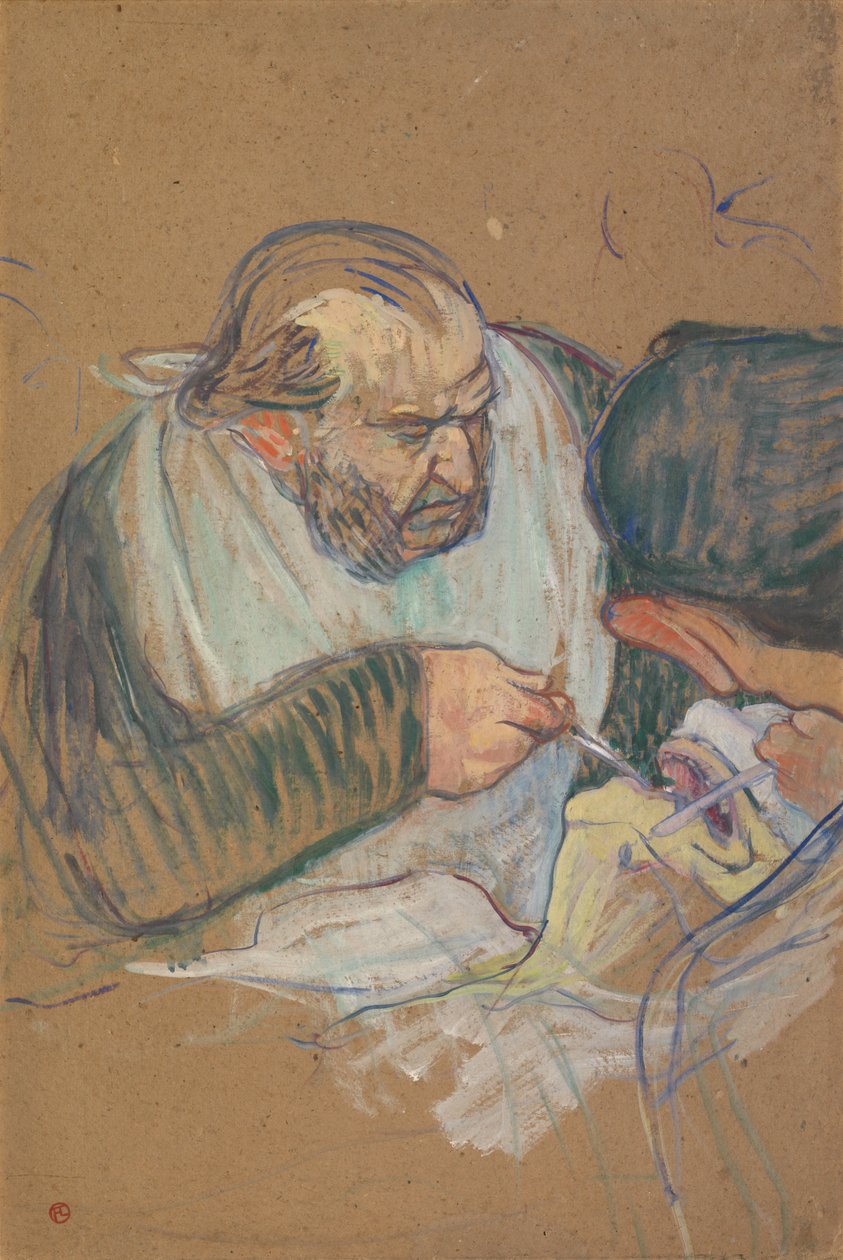 Dr. Péan műtét közben alkotó: Henri de Toulouse-Lautrec