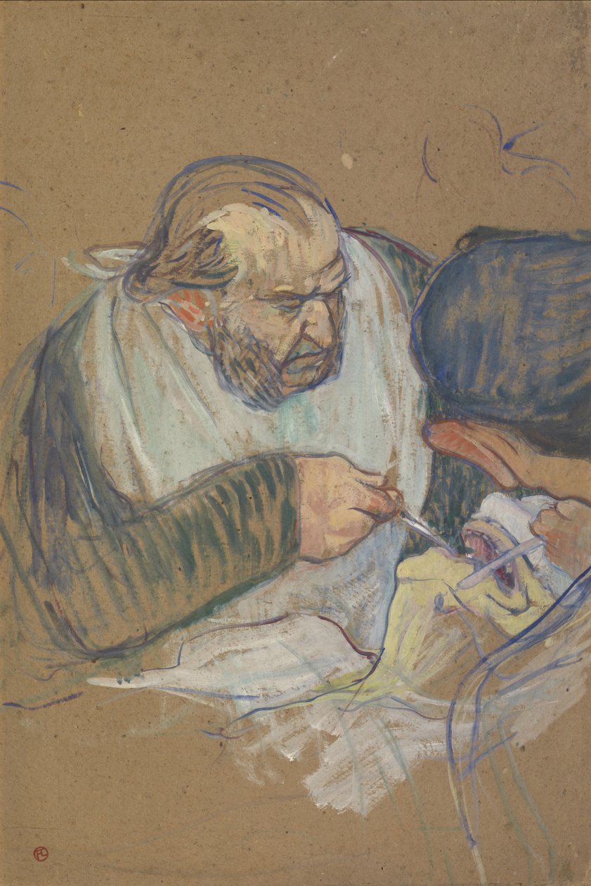 Dr. Péan Üzemeltető, 1891-92 alkotó: Henri de Toulouse Lautrec