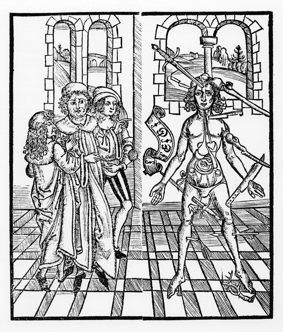 A sebesült ember, a Das Buch der Cirugia című könyvből, Strasbourgban, 1497 alkotó: Hieronymus Brunschwig