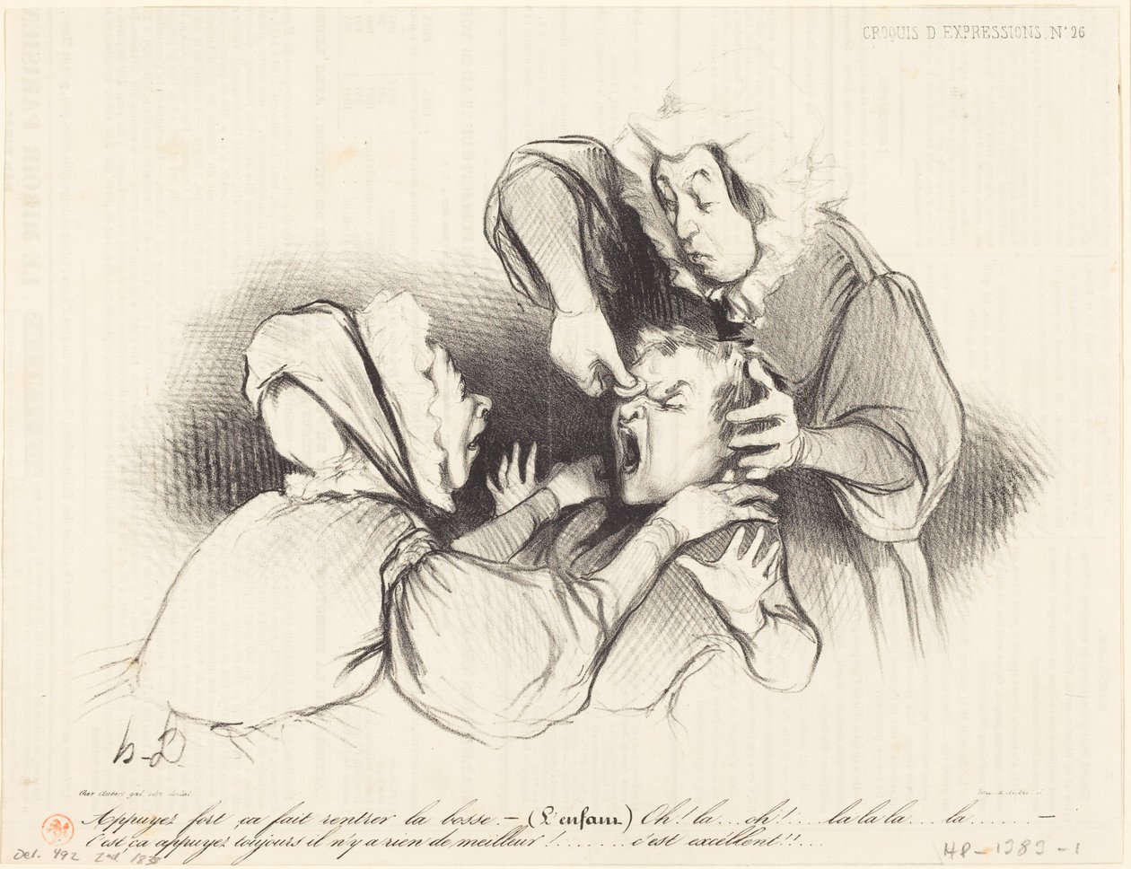 Nyomja erősen, attól visszamegy a dudor... alkotó: Honoré Daumier