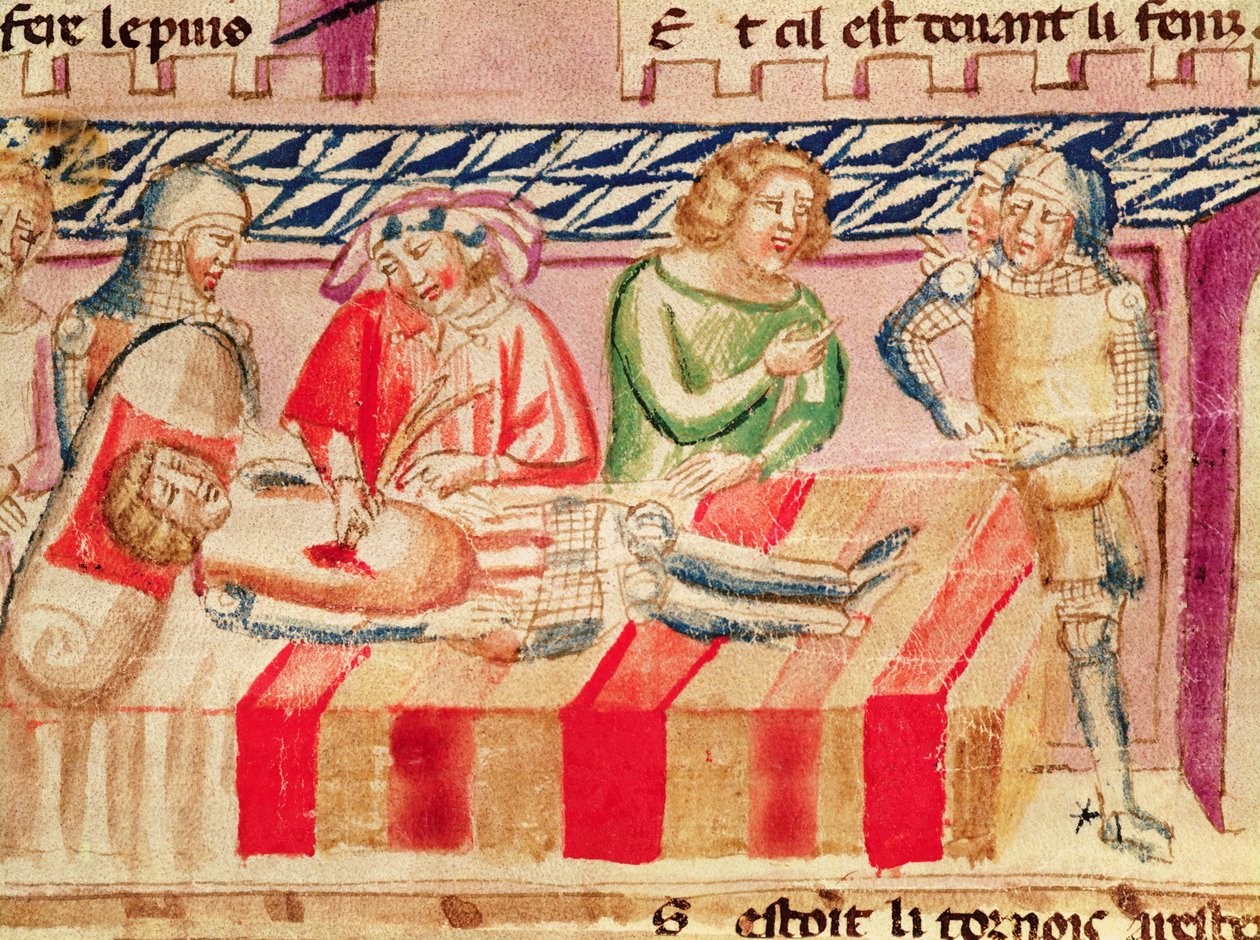Műtét egy sebesült katonán, a "Roman de Troie"-ból alkotó: Italian School