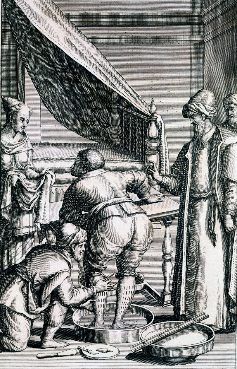 Vérömlés a lábakban, Prospero Alpini Medicina Aegyptiorumból, 1745-ben alkotó: Italian School