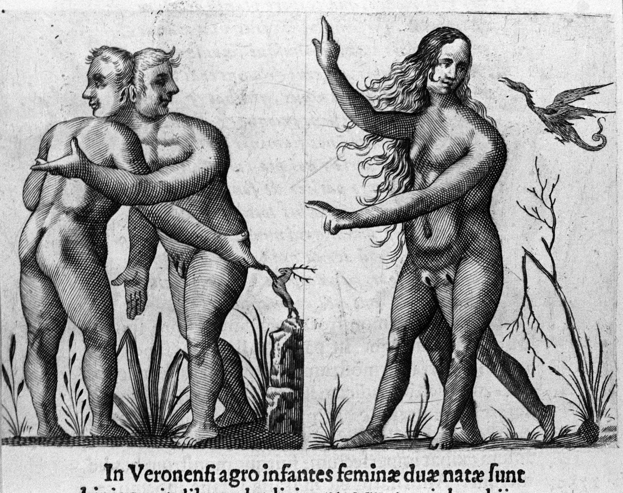Különböző típusú emberi szörnyek: egy férfi kettős testű és fejű, egy nő négy lábbal és két nemű. Fortunio Liceti (1577-1656) olasz tudós „De monstrorum natura, causis et differentiis” metszete. 1646 alkotó: Italian School