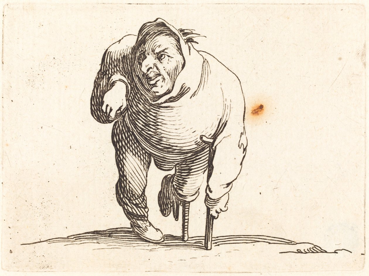 Mankóval és fa lábbal rokkant alkotó: Jacques Callot