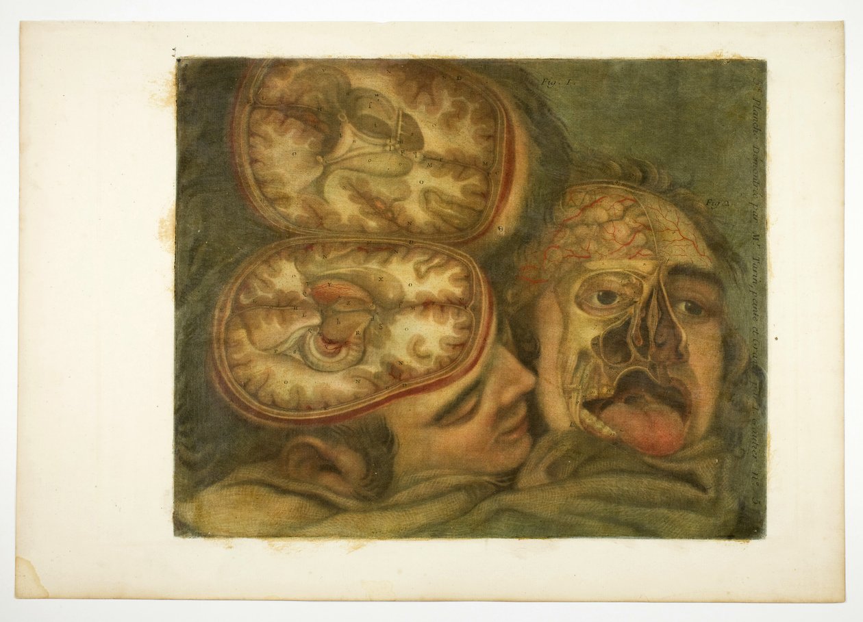 Cranialis Dissection, ötödik lemez, A fej anatómiája, nyomtatott festményekben alkotó: Jacques Fabien Gautier d