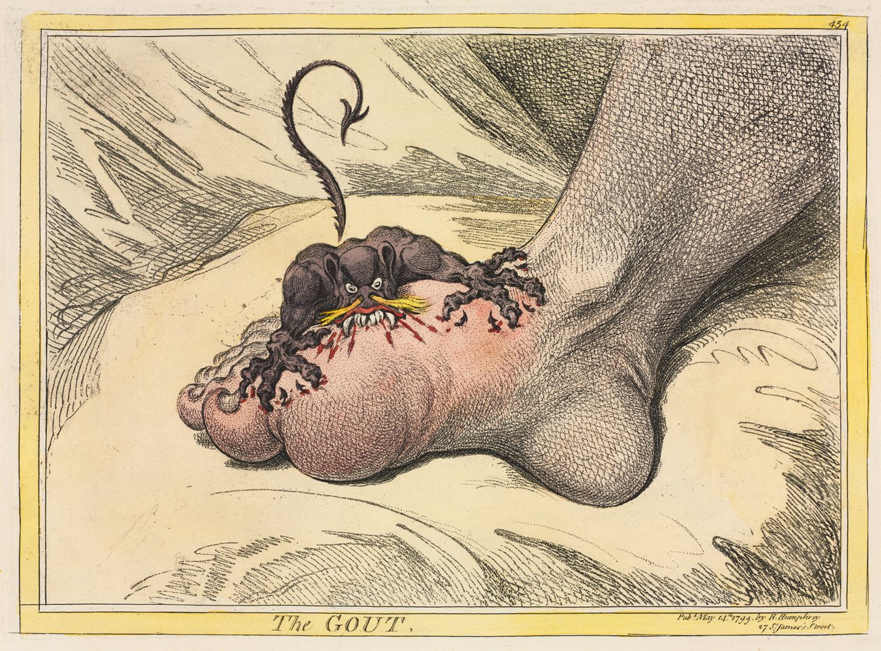 A köszvény alkotó: James Gillray