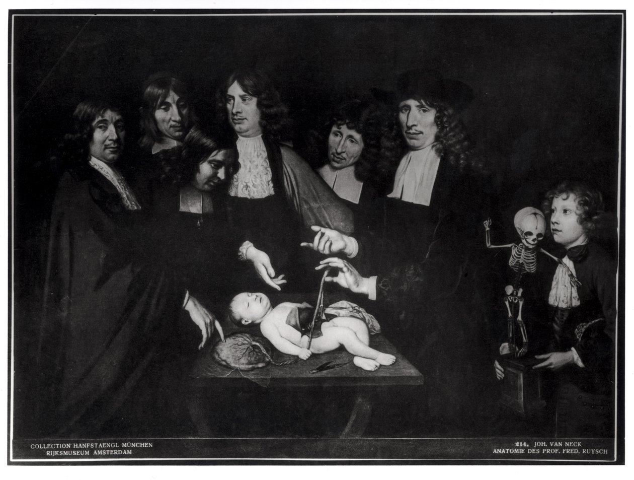 Frederik Ruysch professzor (1638-1731) anatómiai leckéje 1683 körül alkotó: Jan van Neck
