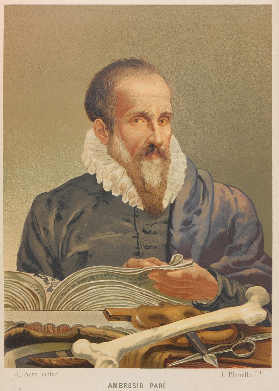 Ambroise Paré portréja, 1879. alkotó: Juan Planella y Rodríguez