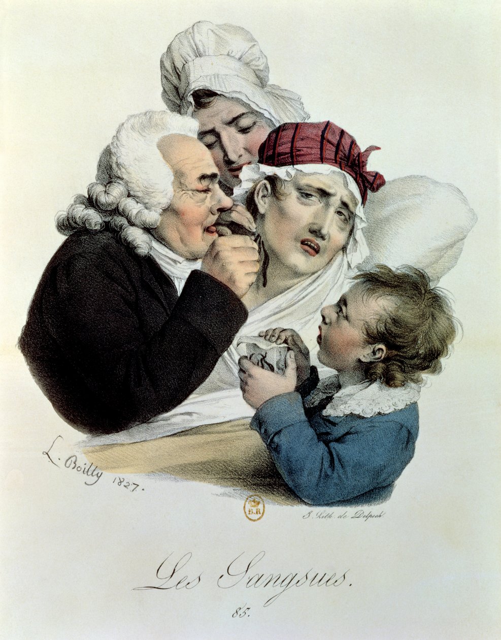 Piócák, Delpech metszete, 1827 alkotó: Julien Leopold Boilly