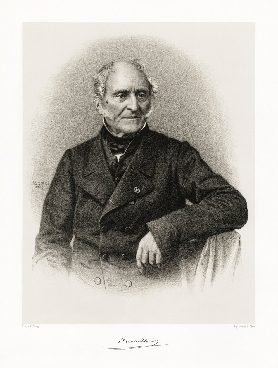 Jean Cruveilhier, 1865-66 alkotó: Lasnier
