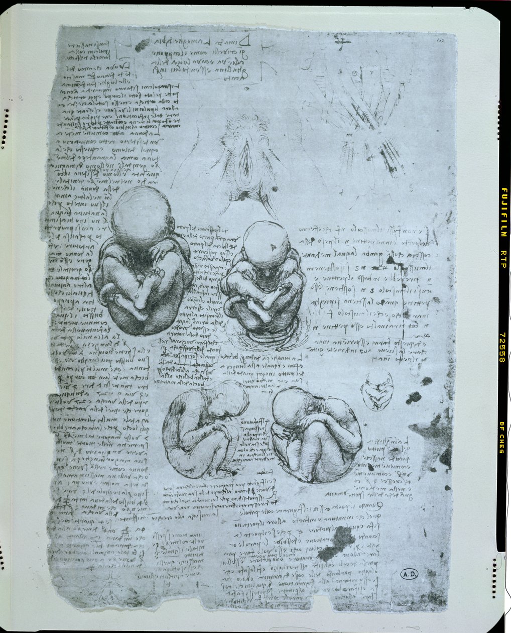 Öt nézet egy magzatról az anyaméhben, fakszimile másolat alkotó: Leonardo da Vinci
