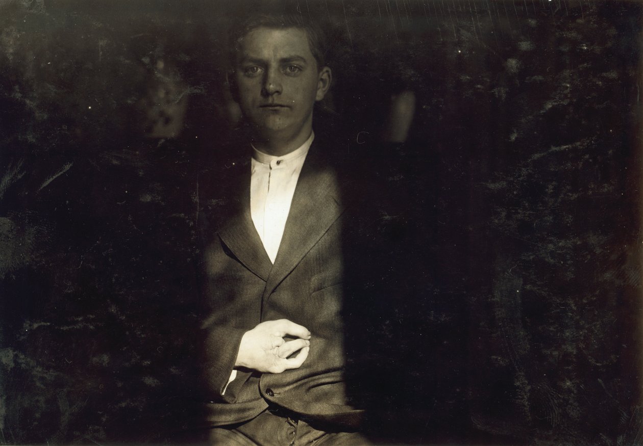 A brooklyni Frank Wiegel, aki 15 évesen napi 18 órás munka után megsérült, két ujját amputálták a jobb kezéről, New York városában alkotó: Lewis Wickes Hine
