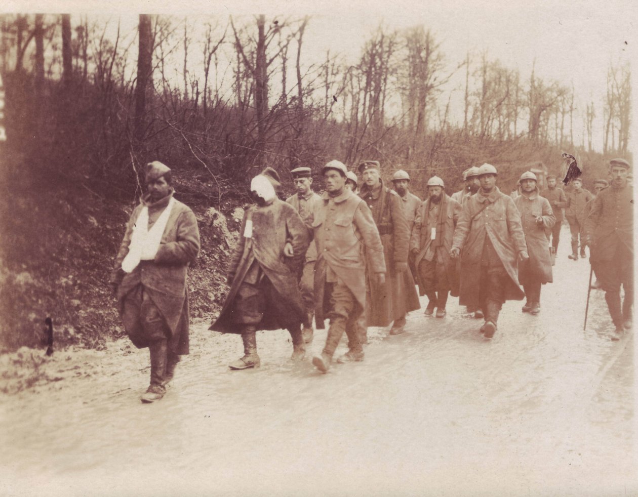 1917. február – Verdun-Front francia foglyok megsebesültek, német katonák kísérték vissza őket alkotó: Unbekannt Unbekannt