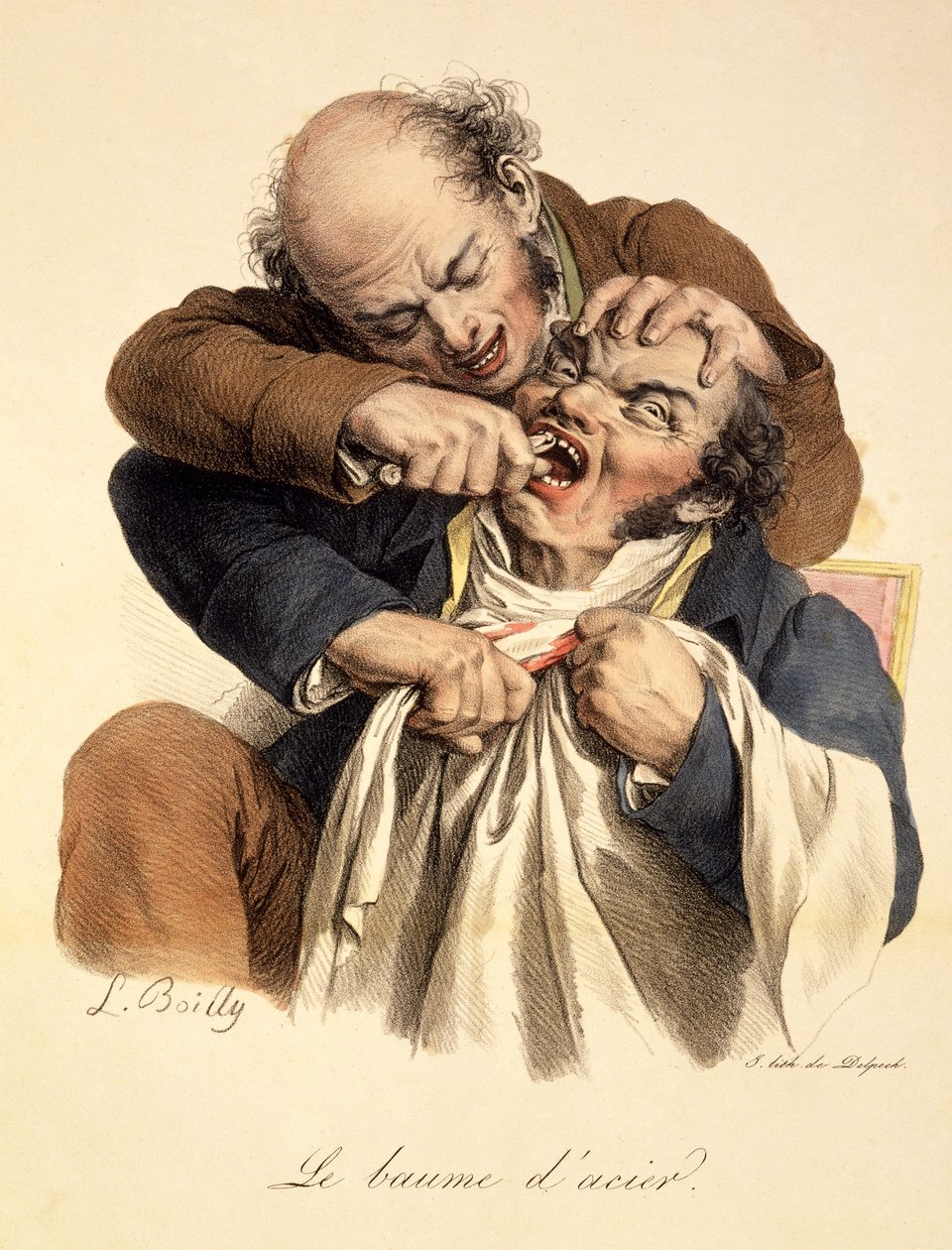 The Steel Balsam - Having a Tooth Pulled, kocsma. Párizsban, 1826 alkotó: Louis Leopold Boilly