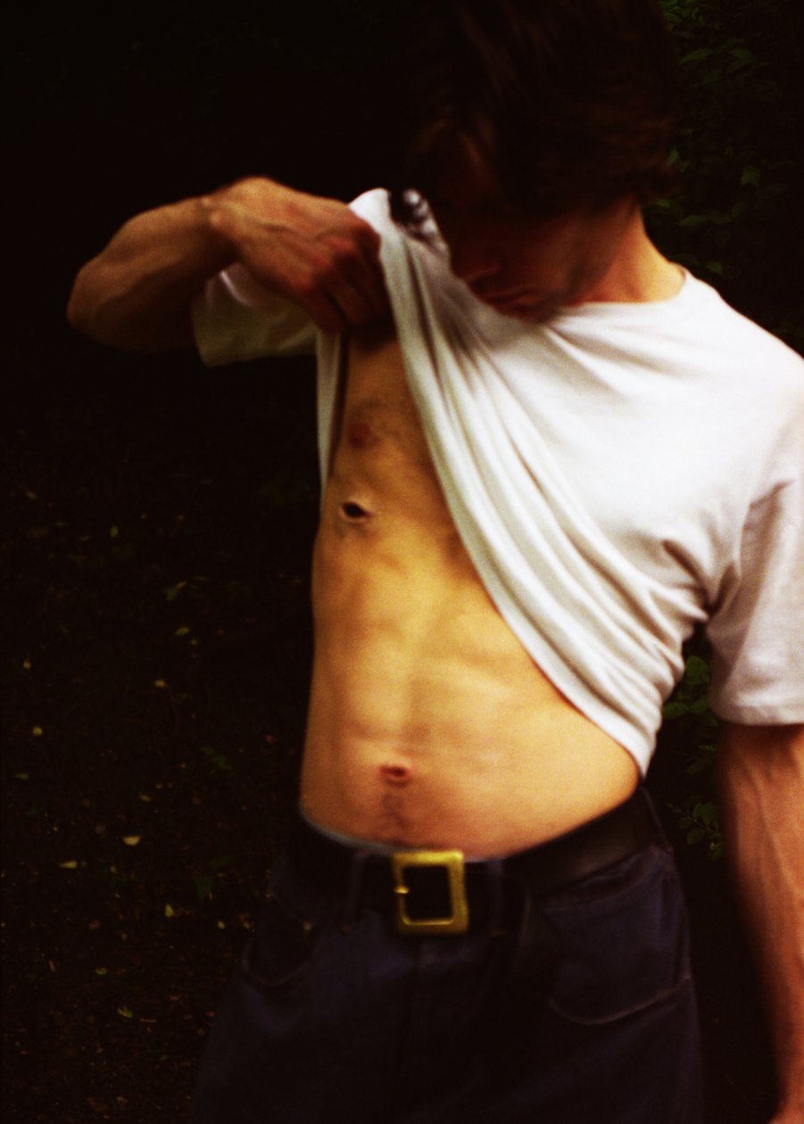 Seb alkotó: Mat Collishaw