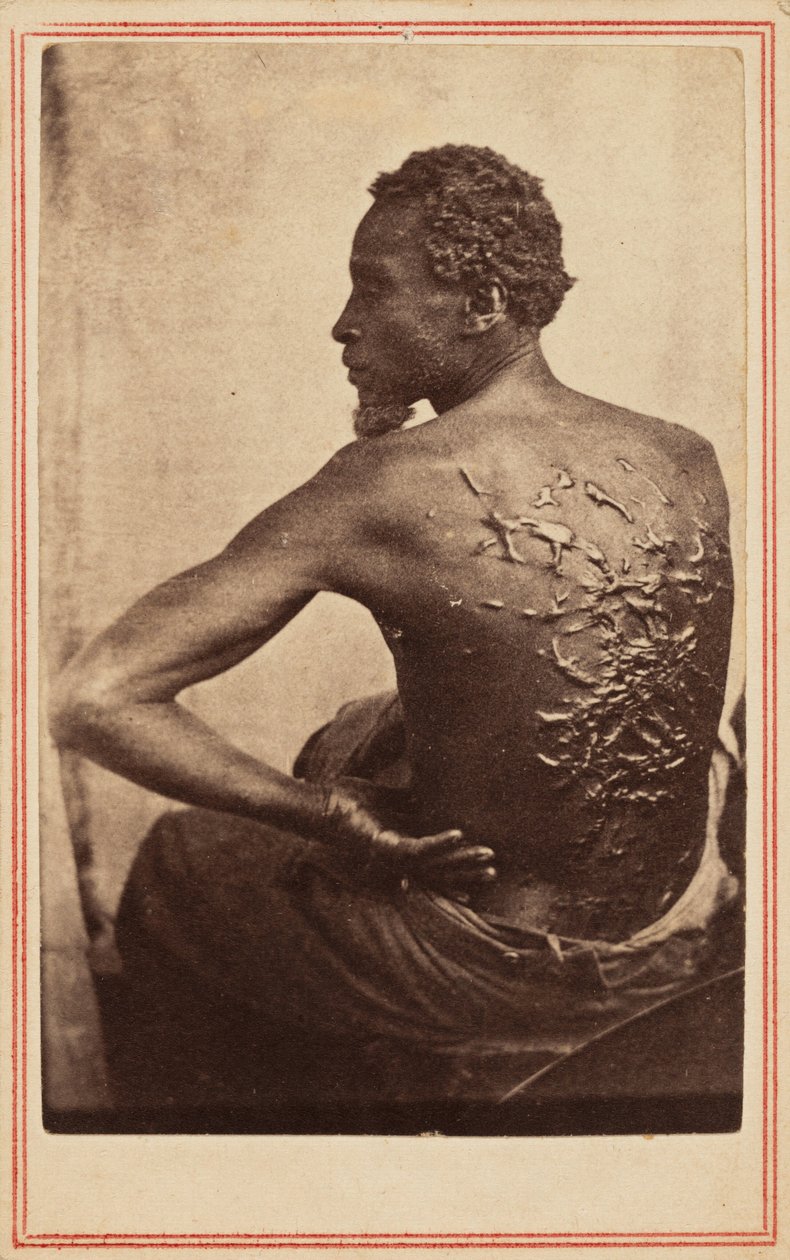 A megostorozott hát,c. 1863 (fotó) alkotó: McPherson & Oliver