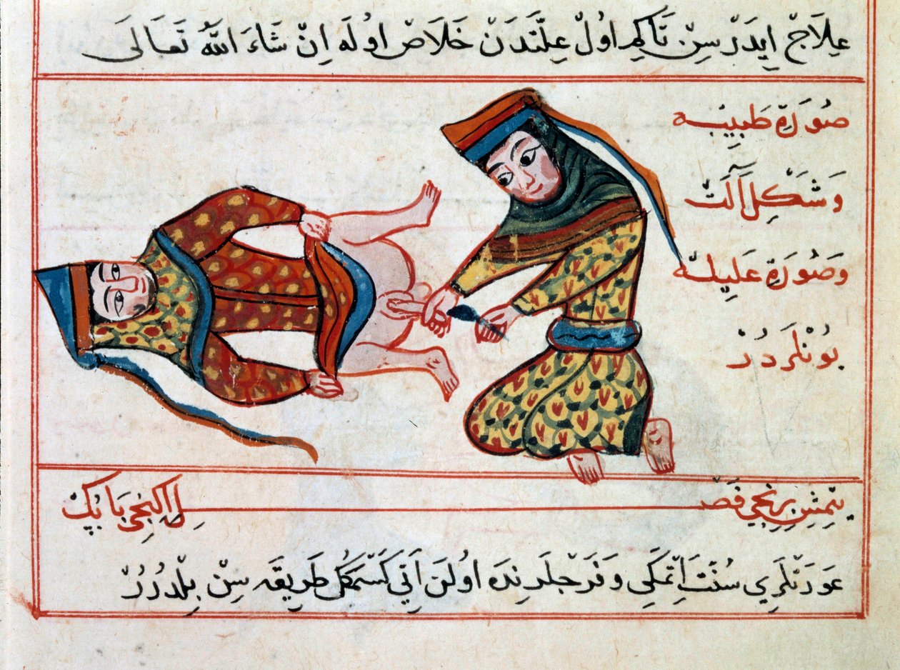 Orvostudomány: hermaphoditis műtéte. Miniatűr Sharaf al-din egy csemegéből a török orvoslásból alkotó: Ottoman School