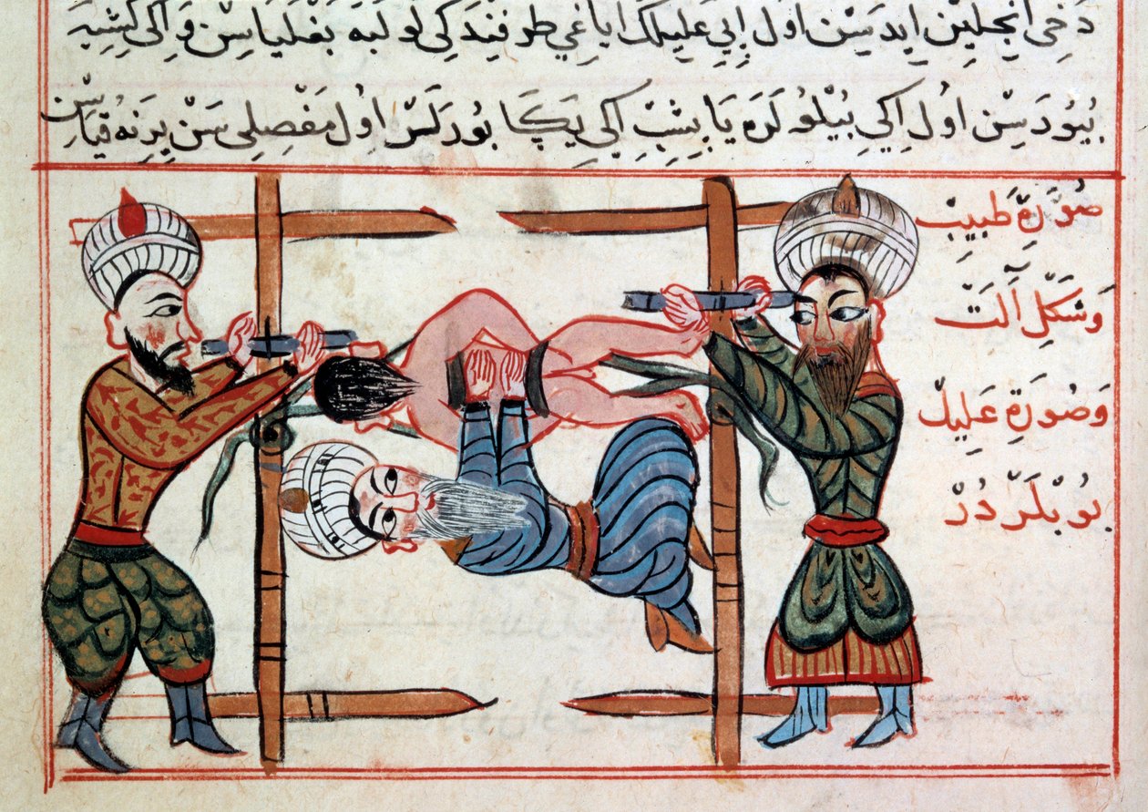 A törés csökkentése. Miniatűr Sharaf al-din egy csemegéből a török orvoslásból alkotó: Ottoman School