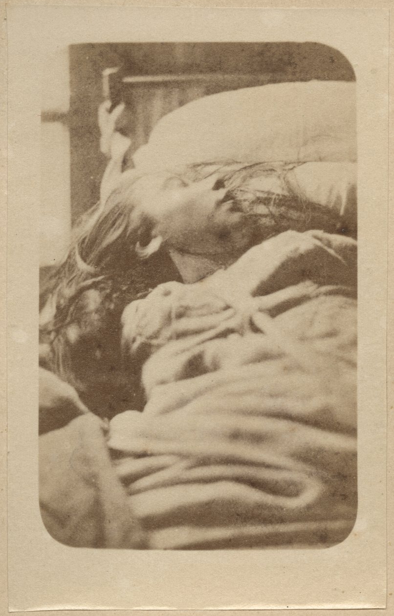 A hisztéria támadása, első fázis, illusztráció a Bourneville et P. Regnard „Iconographie Photographique de La Salpetriere” című művéből, II. tábla, Párizs, 1876 (albumnyomat) alkotó: Paul Regnard