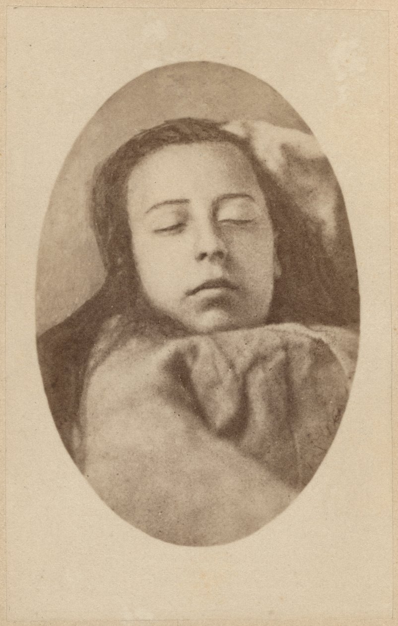 A hisztéria támadása, második fázis, illusztráció a Bourneville et P. Regnard „Iconographie Photographique de La Salpetriere” című művéből, III. tábla, Párizs, 1876 (albumnyomat) alkotó: Paul Regnard