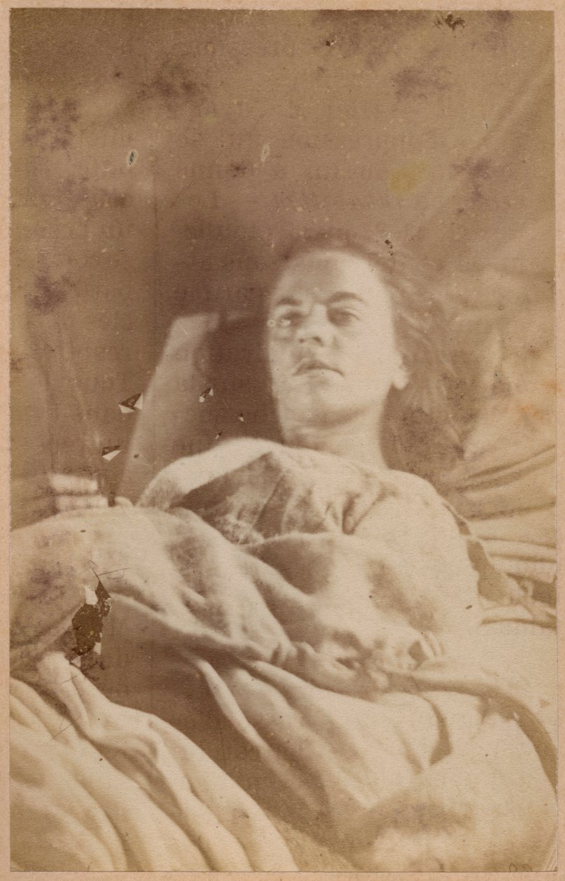 Hisztérikus epilepszia, roham, harmadik periódus, XXVI. tábla a Bourneville et P. által készített "Iconographie Photographique de La Salpetriere" című műből. Regnard, Párizs, 1876 (albumin nyomat) alkotó: Paul Regnard