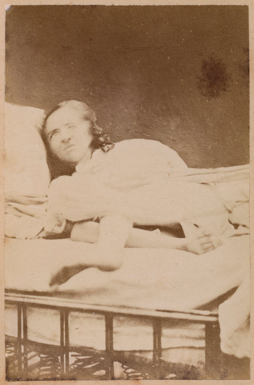 Hisztérikus epilepszia, torzulások, XXXVIII. lemez a Bourneville et P. által készített "Iconographie Photographique de La Salpetriere" című műből. Regnard, Párizs, 1876 (albumin nyomat) alkotó: Paul Regnard