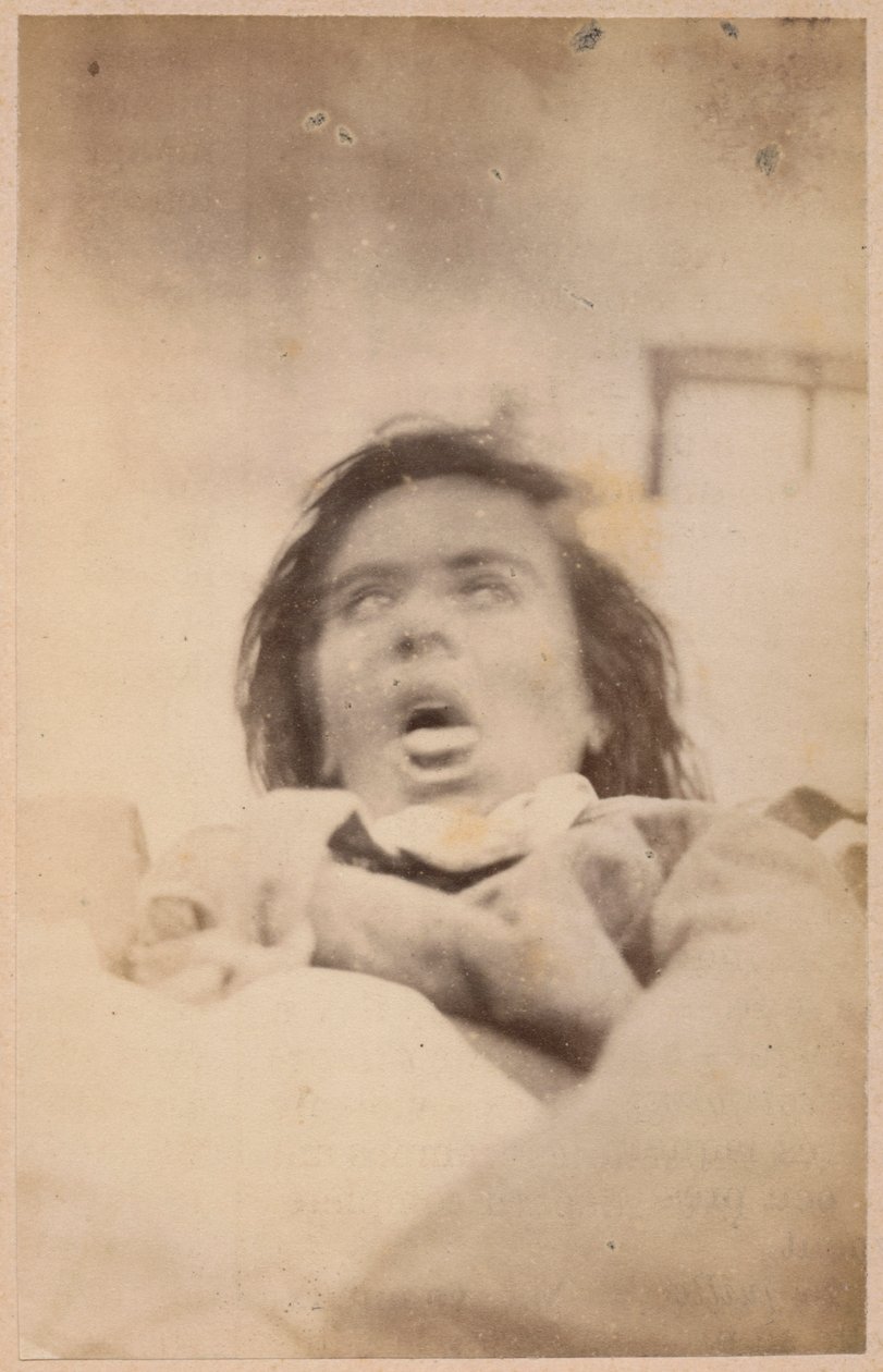 Hisztérikus epilepszia, hallucinációk, szorongás, XXIX. tábla a Bourneville et P. "Iconographie Photographique de La Salpetriere" című művéből. Regnard, Párizs, 1876 (albumin nyomat) alkotó: Paul Regnard