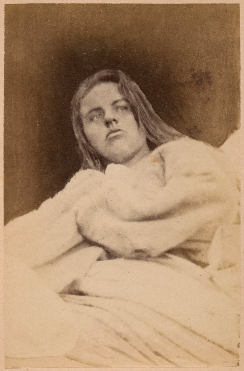 Hisztérikus epilepszia, hallucinációk, megvetés, XXXI. lemez az „Iconographie Photographique de La Salpetriere”-ből, Bourneville és P. Regnard, Párizs, 1876 (albumnyomat) alkotó: Paul Regnard