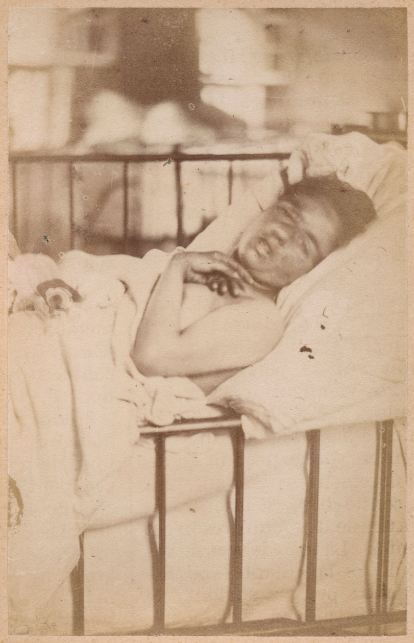 Hisztérikus epilepszia, állandó összehúzódás, XXVIII. lemez a Bourneville et P. Regnard által készített "Iconographie Photographique de La Salpetriere"-ből, Párizs, 1876 (albuminnyomat). alkotó: Paul Regnard