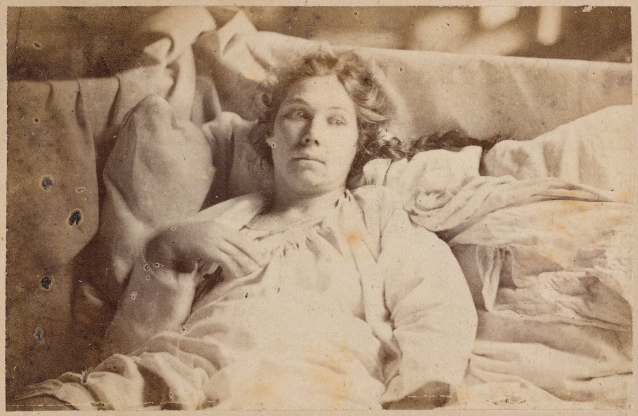 Hisztérikus epilepszia, terminális fázis, melankolikus delírium, Bourneville et P. Regnard „Iconographie Photographique de La Salpetriere” illusztrációja, XIX. lemez, Párizs, 1876 (albumnyomat) alkotó: Paul Regnard