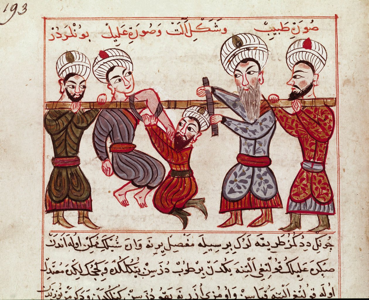 Orvostudomány: ortopédiai beavatkozás. Miniatűr, amelyet Charaf-ed-din (Charaf ed Din) (1404-1468) a török orvoslás fejéséből vett a „” La Surgery Imperiale” után” (Ms Sup Turk 693 fol. 193) 1466 Paris, B.N. alkotó: Persian School