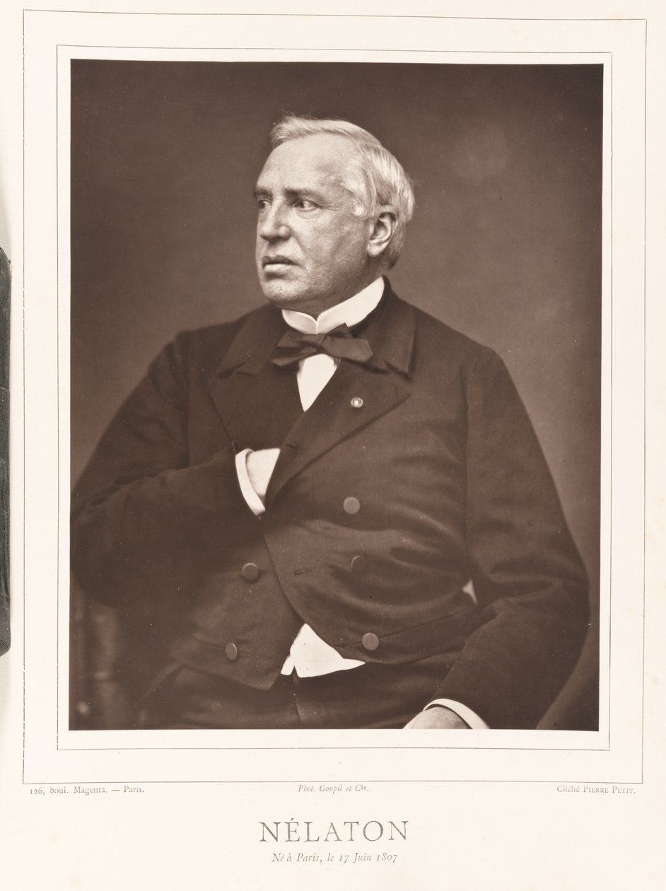 Nélaton alkotó: Pierre Petit
