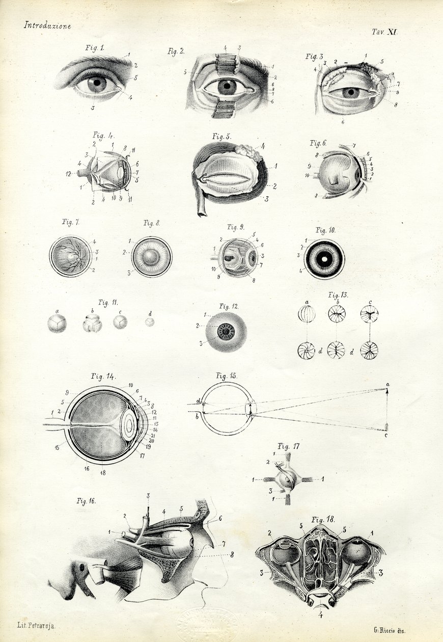 Látásszerve, 1863-79 alkotó: Raimundo Petraroja