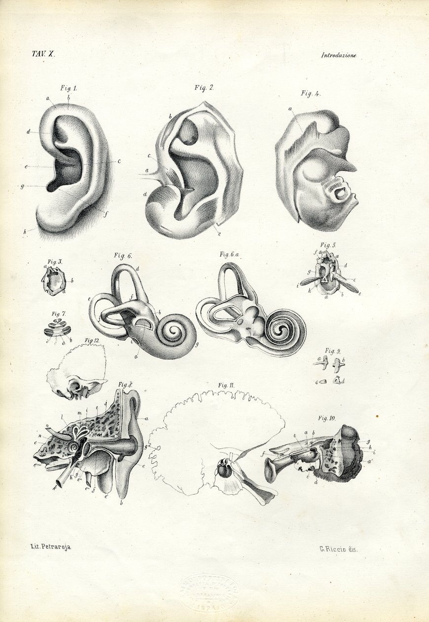 Hallásszerve, 1863-79 alkotó: Raimundo Petraroja