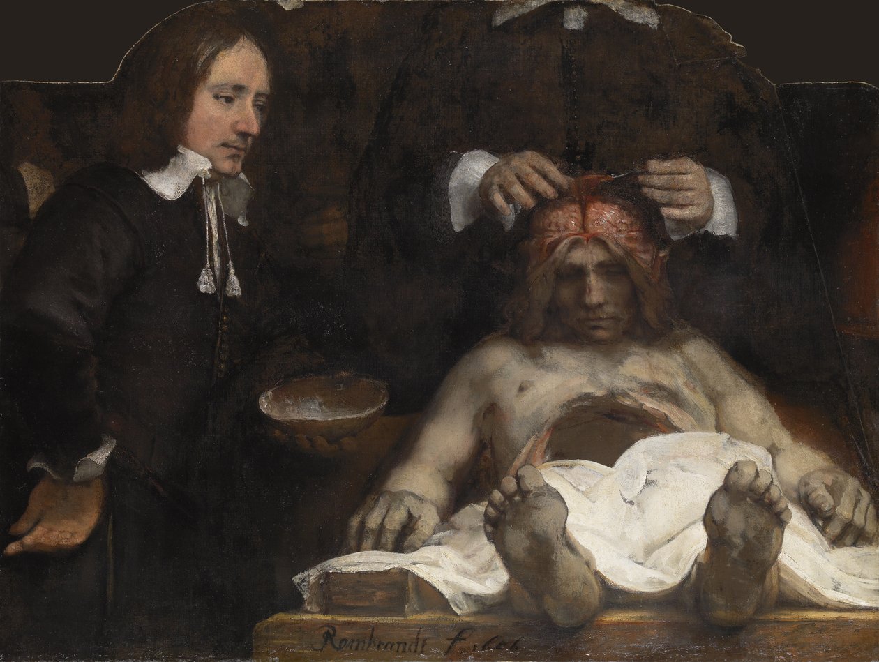 Dr. Jan Deyman anatómiai leckéje, 1656 alkotó: Rembrandt van Rijn