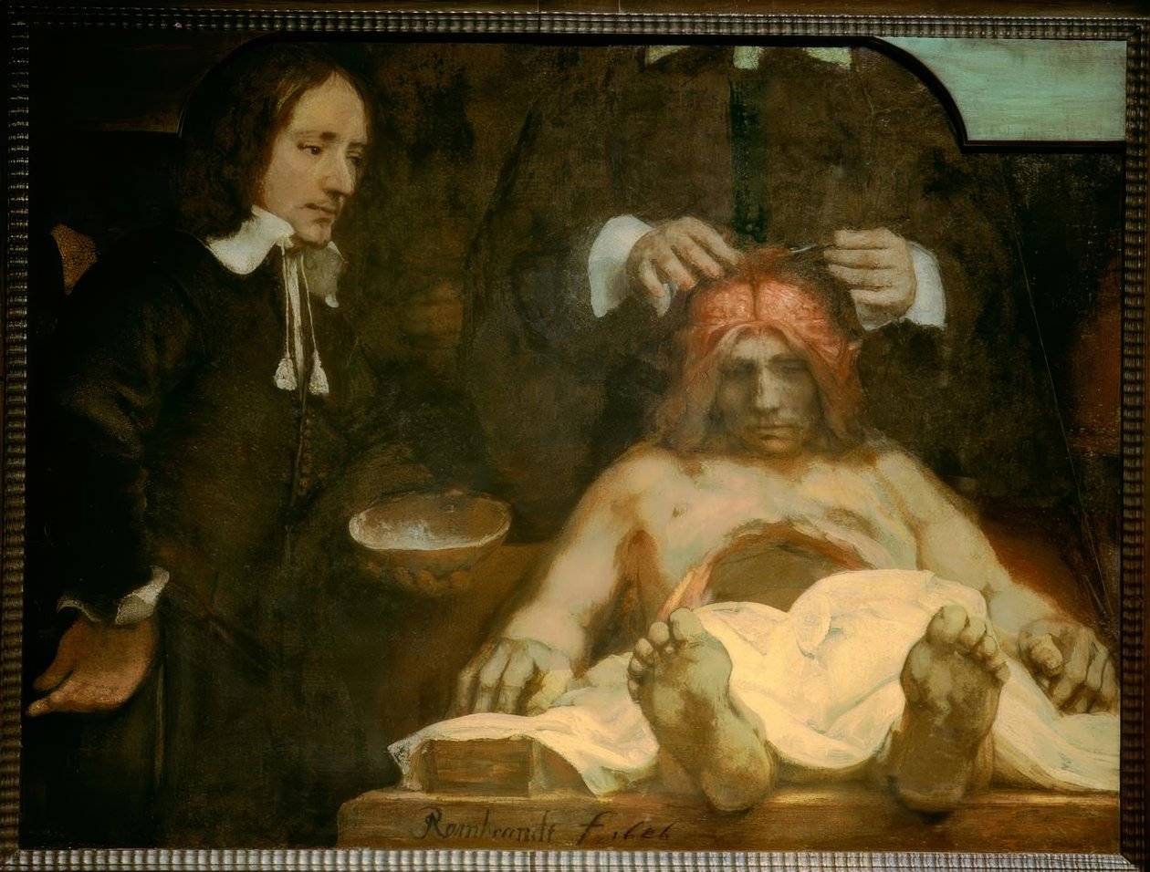Az anatómia Dr. Johan Deijman alkotó: Rembrandt van Rijn