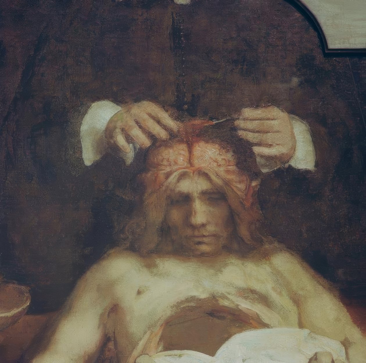Az anatómia Dr. Johan Deijman alkotó: Rembrandt van Rijn