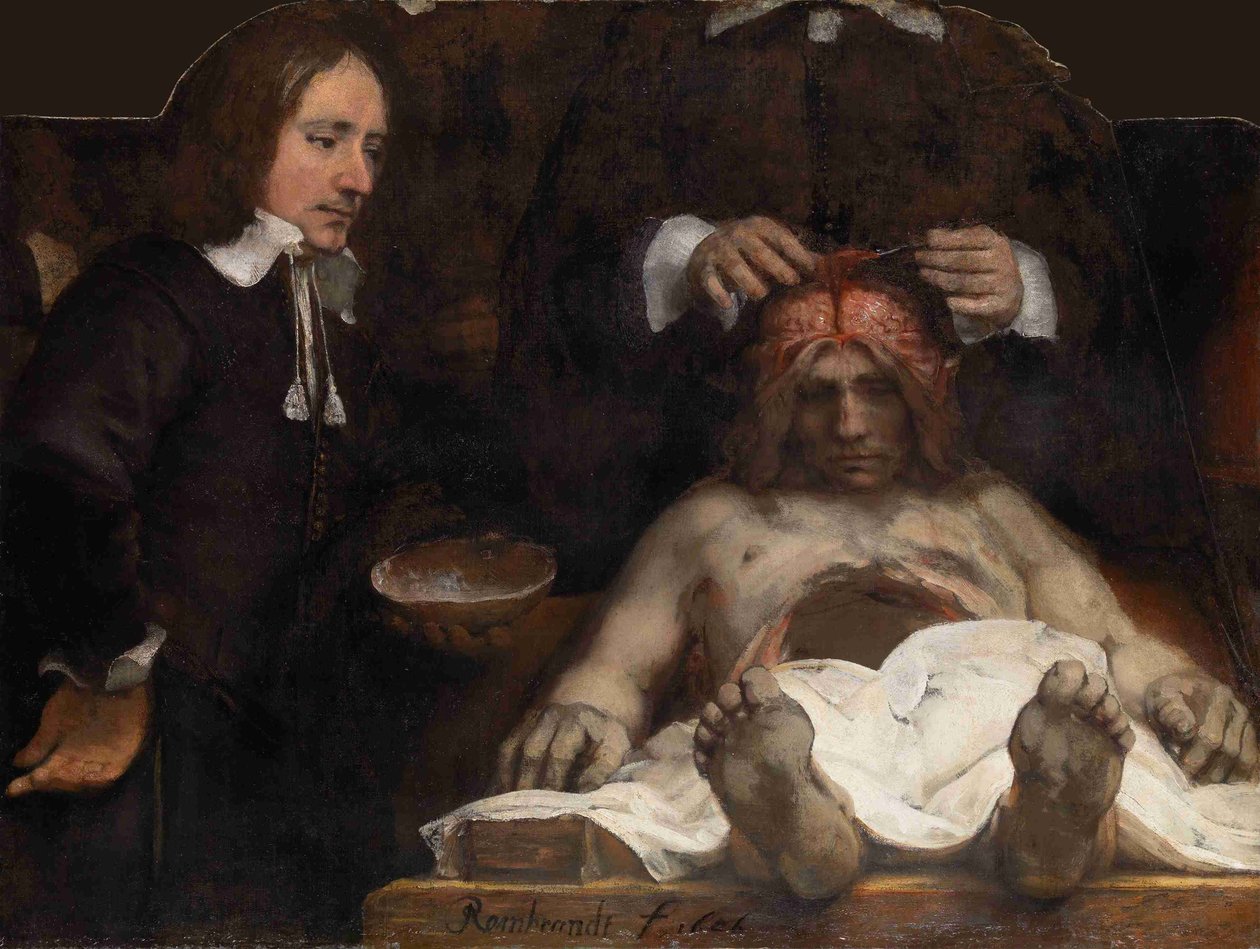 Dr. Jan Deijman anatómiai leckéje, 1656 alkotó: Rembrandt van Rijn