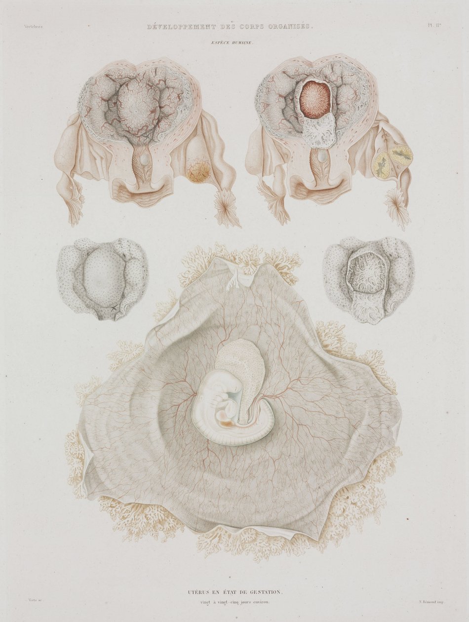 Nőgyógyászat Emberi méh embrióval, c 1847-1859 alkotó: John Pardon