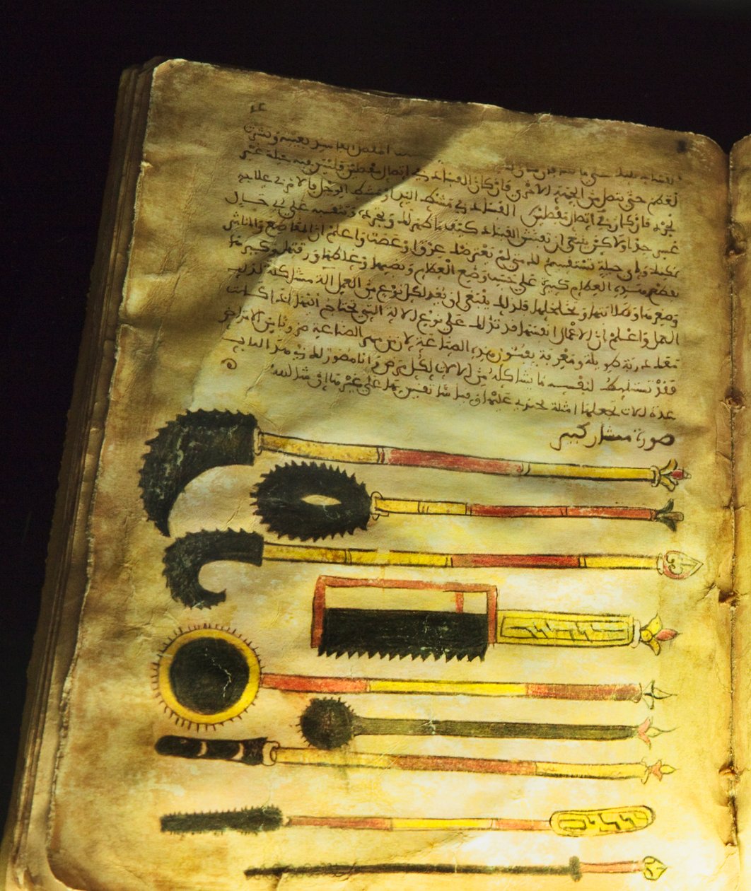 Illusztráció az Abu al-Qasim al-Zahrawi által írt "A sebészetről és a műszerekről" vagy "Al-Zahrawi" című műből. alkotó: Unbekannt Unbekannt