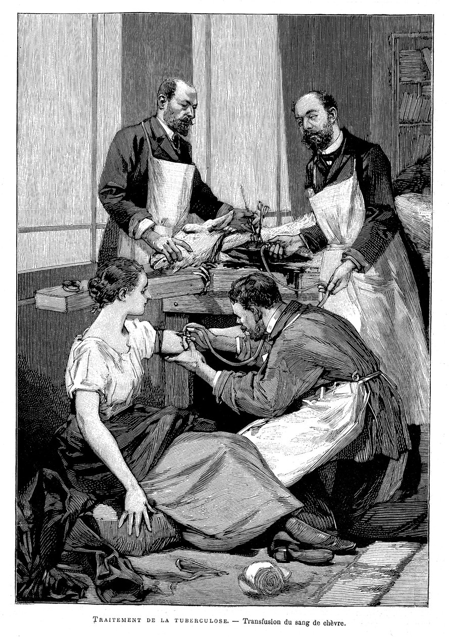 Egy tuberkulózisos betegnek kecskevért adnak át, 1891 alkotó: Unbekannt