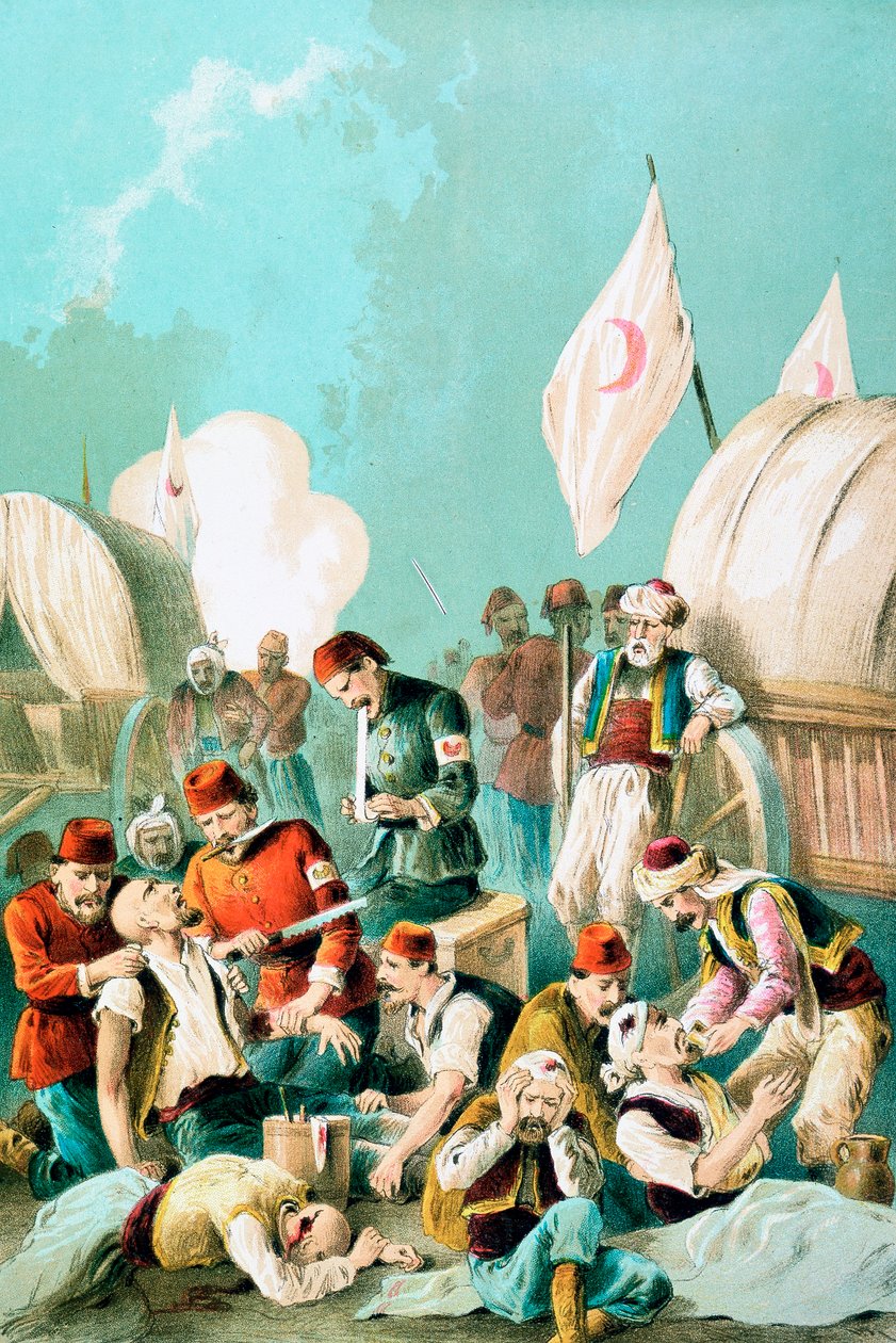 Érzéstelenítés nélkül amputálják a karját, orosz-török háború, 1877 alkotó: Unbekannt