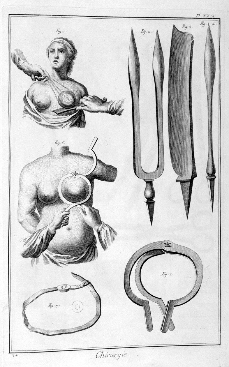 Mellsebészet, 1751-1777 alkotó: Unbekannt