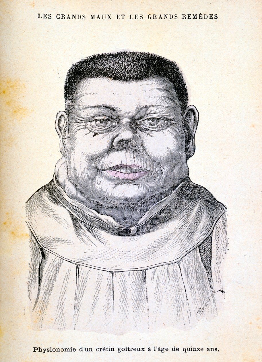 Kretén 15 éves, 1890 körül alkotó: Unbekannt