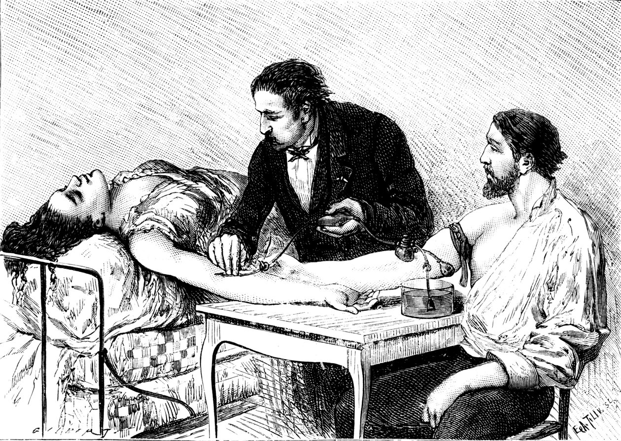 Dr. Roussell Genfből, aki egy nőnek közvetlen vérátömlesztést adott egy önkéntestől, 1882 alkotó: Unbekannt